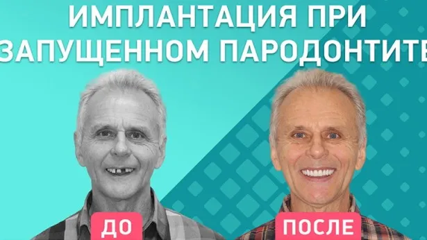 Отзыв пациента